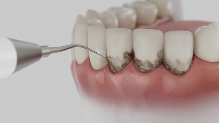 Trusted Dental Implants service in St. Martin, MS - Dentist Open Now